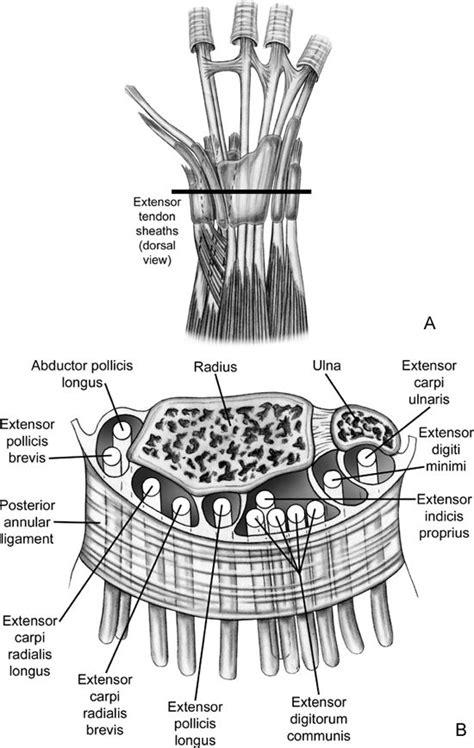 Dorsal compartments of the wrist Tendinitis Anatomía Indices