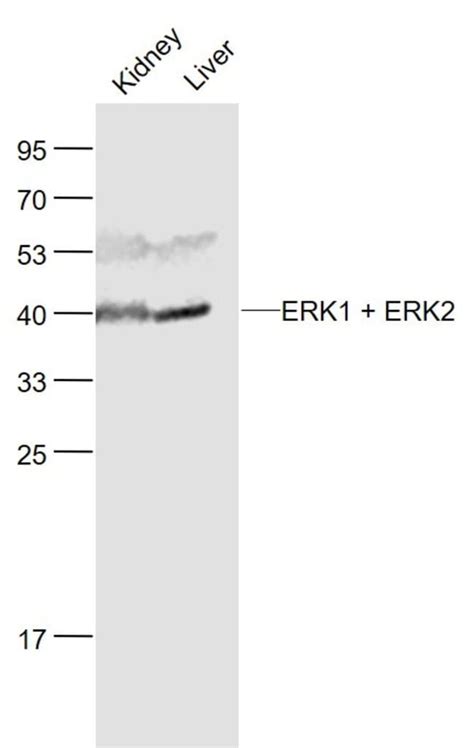 ERK1 2 Rabbit anti Human Mouse Rat Polyclonal Bioss 100 μL