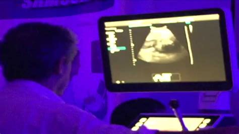 Realizan Conferencia Ultrasonido En Obstetricia Y Diagn Stico Prenatal