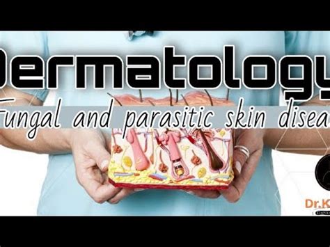 Dermatology 5 Tinea Pediculosis And Scabies YouTube