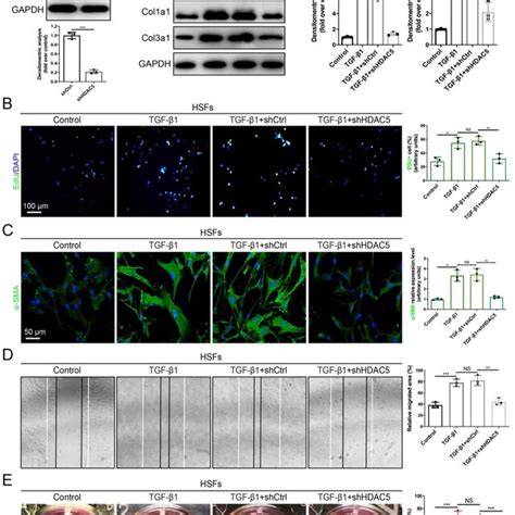 Hdac Knockdown Inhibits Tgf Induced Hsf Activation A