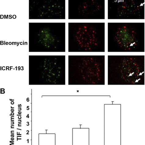 Telomere Dysfunction Induced By Icrf A Representative Images Of