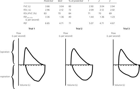 A Stepwise Approach To The Interpretation Of Pulmonary Function Tests