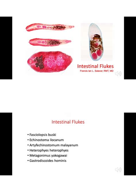 Intestinal Flukes | PDF