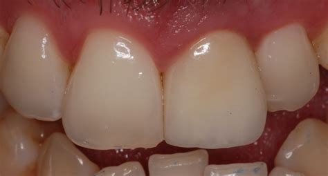 Prosthodontics & Dental Implants - Clinic 334