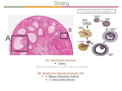 Histology OSPE about Female reproductive system | PPT