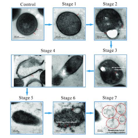 | TEM micrograph showing the four changing stages of mesosome-like... | Download Scientific Diagram