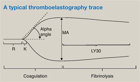 Physiology Of Haemostasis Anaesthesia And Intensive Care Medicine