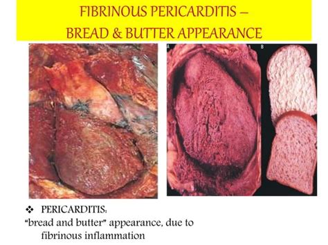 The Cardiovascular System Part 2 Ppt