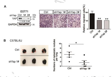 Figure From Yap Promotes Breast Cancer Metastasis By Repressing