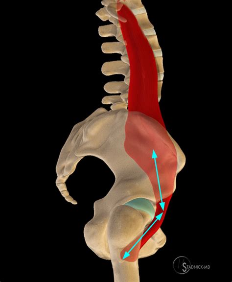 Iliopsoas Strain