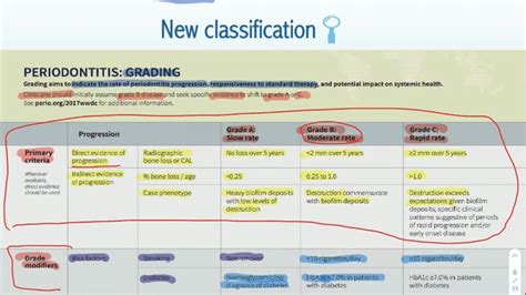 New Periodontal Classification For SDLE By Saud Alqahtani YouTube