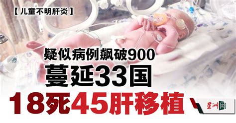 儿童不明肝炎疑似病例飙破900！蔓延33国 18死45人需肝移植 国际 带你看世界