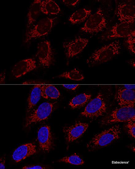 High Affinity And Specificity KO Validated TOM20 Polyclonal Antibody