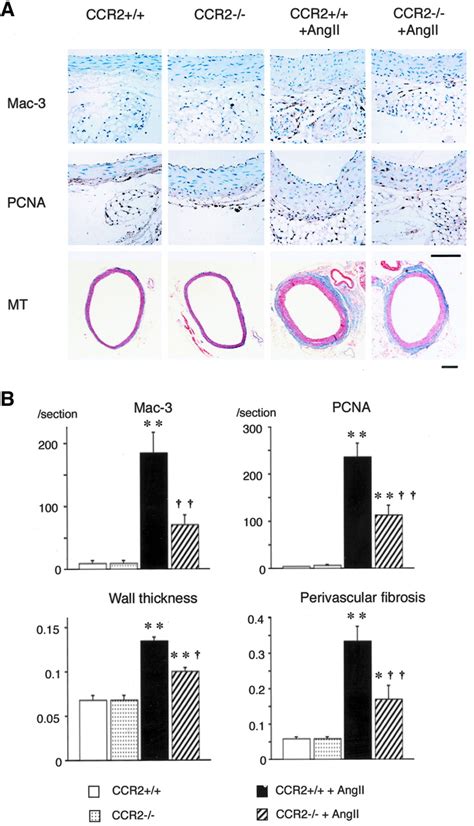 Critical Role Of Monocyte Chemoattractant Protein 1 Receptor Ccr2 On