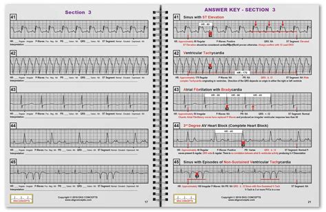 Snapklik R Cat Ekg Workbook Series