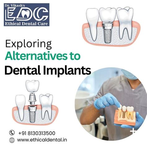 Exploring Alternatives To Dental Implants