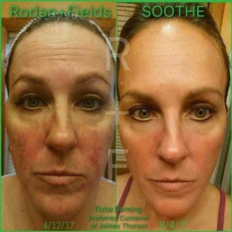 Soothe To The Rescue It Helps To Calm Red Skin And Is Great For