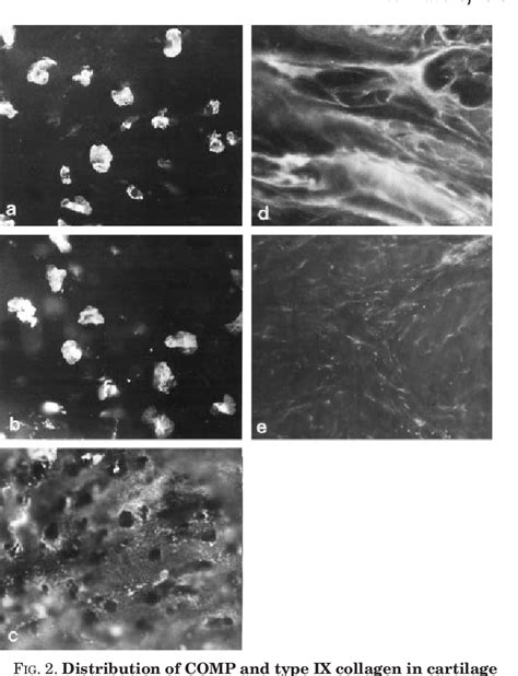 Figure From The Fate Of Cartilage Oligomeric Matrix Protein Is