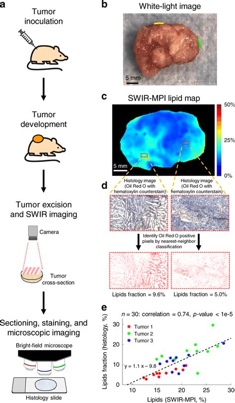 Ex Vivo Mapping Of Tumor Lipid Heterogeneity A Scid Mice Were