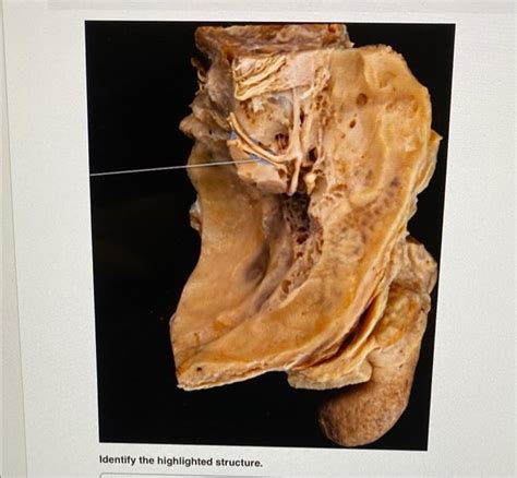 Solved Identify The Highlighted Structure Identify The Hi