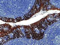 Cytokeratin