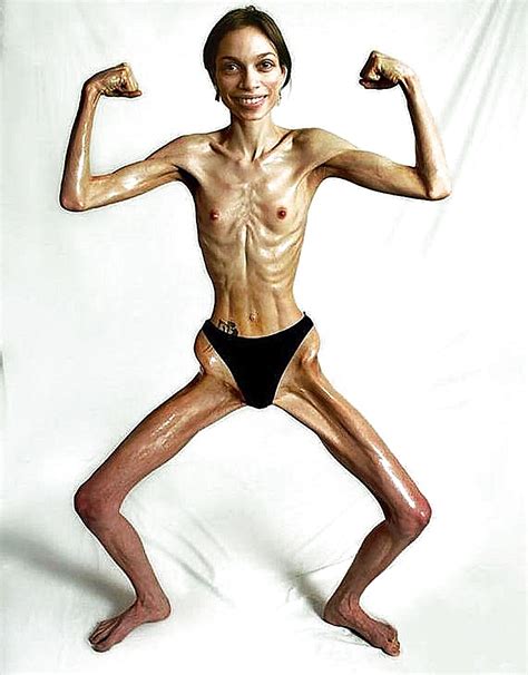 Anorexic Porn Pictures XXX Photos Sex Images 1890854 PICTOA