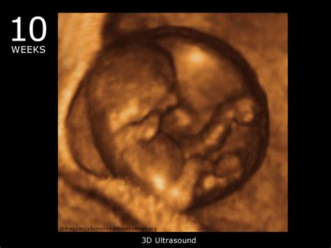 10 Week 3D Ultrasound Baby Picture | Pregnancy Symptoms Week by Week