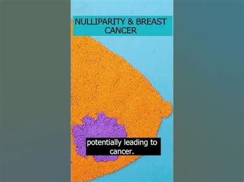 Explore the scientific link between nulliparity and breast cancer risk ...