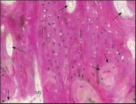 A The Regenerated Bone Region Presented Features Of Mature Bone With