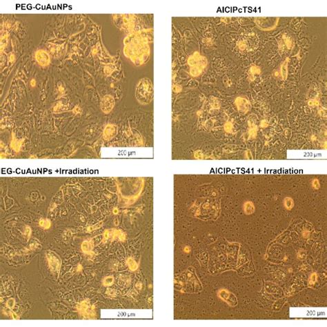 Cellular Morphology Of Caco 2 Cells After AlClPcTS41 PEG CuAuNPs And