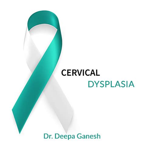 Cervical Dysplasia Histology