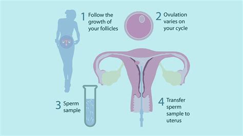 Iui Intra Uterine Insemination Dr Preeti Mahawar