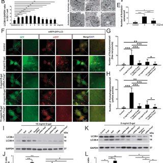 The Expression Of FOXG1 Affects Apoptosis In OC1 Cells After D Gal