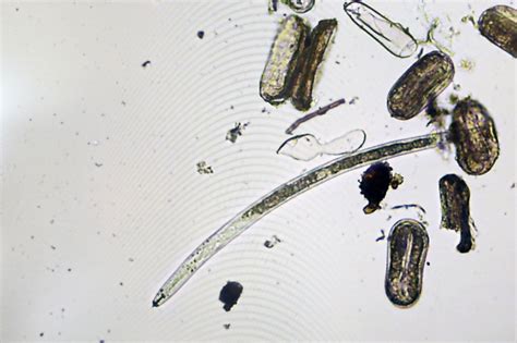 WUR launches major nematodes research project - Potatoworld