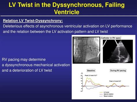 PPT Left Ventricular Twist Mechanics In Heart Failure PowerPoint