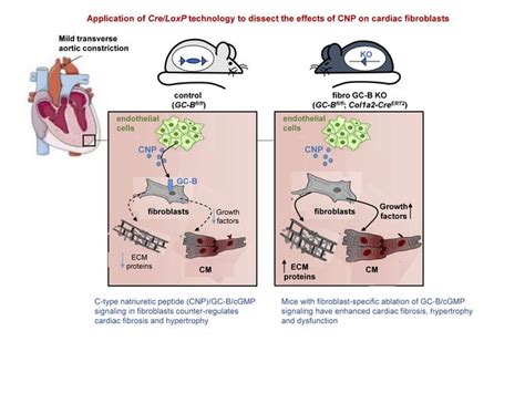 JCI Insight Ablation Of C Type Natriuretic Peptide CGMP Signaling In