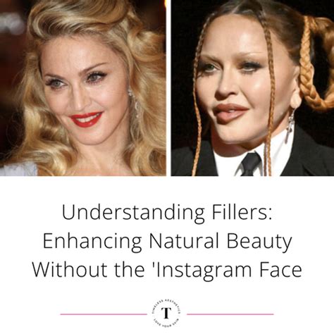 Understanding Fillers: Enhancing Natural Beauty Without the 'Instagram ...