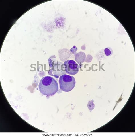 Abnormal Cells Body Fluids Stock Photo Shutterstock