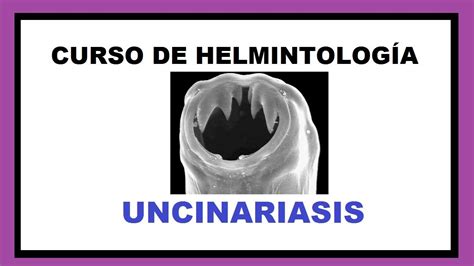 Todo Sobre La Uncinariasis Curso De Helmintología Youtube