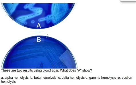 A 0 These are two results using blood agar: What does "A" show? a ...