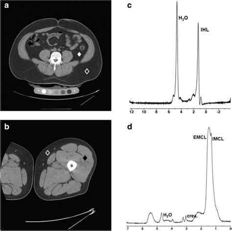 Sex Differences In Body Composition And Association With