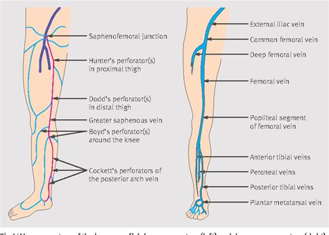 Figure 1 From Management Of Venous Ulcer Disease Semantic Scholar