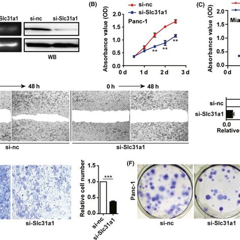 Slc31a1 Knock‐down Inhibited Pancreatic Cancer Progression A After