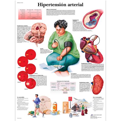 Lámina Hipertensión arterial Ortogim