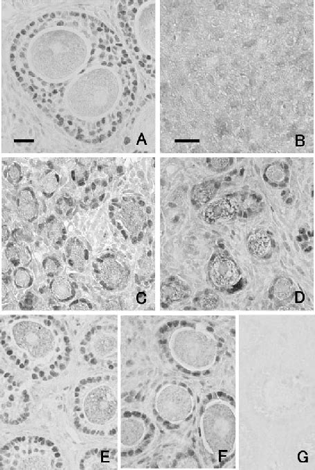 Immunohistochemical Staining Of Erβ Protein In Ovaries Of C57bl6j