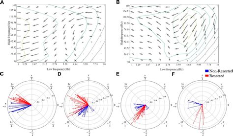 Frontiers Classifying Epileptic Phase Amplitude Coupling In Seeg