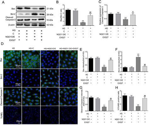 Effect Of Ex527 On Apoptosis In Nqo1 Pcdna Treated Hk 2 Cells Under Hg