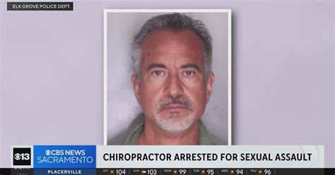 Elk Grove Chiropractor Jeffrey Labrado Accused Of Sexually Assaulting Teenage Patient Cbs