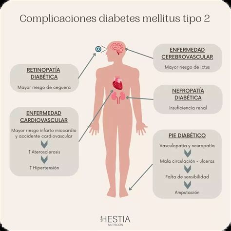 Diagrama De Fisiopatología De La Diabetes Tipo 2